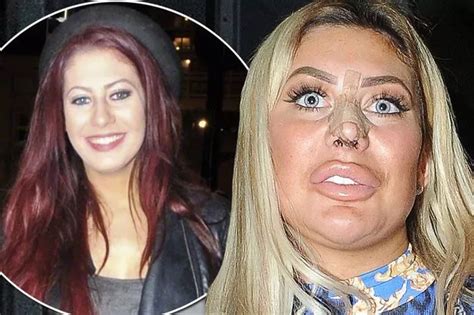 chloe ferry bbl|chloe ferry plastic surgery.